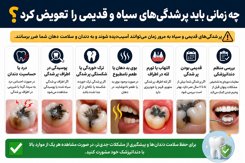 تعویض پر شدگی دندان با مواد سیاه