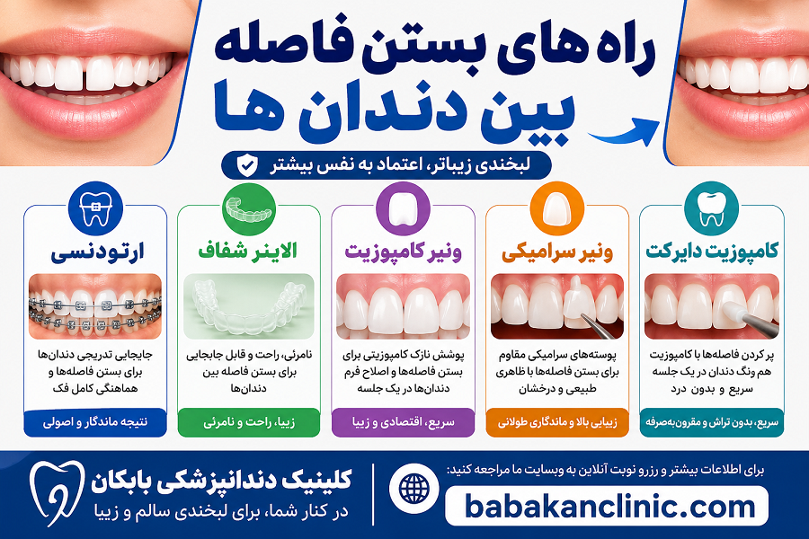 بستن فاصله بین دندان ها