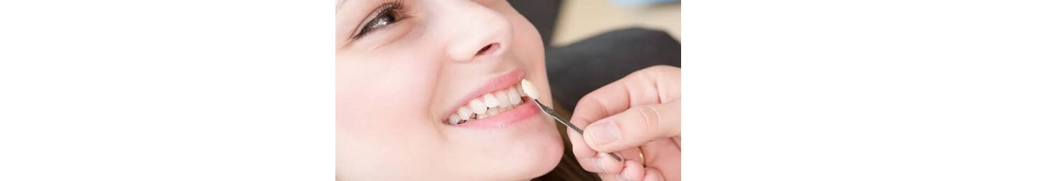 لمینت دندان درد دارد؟
