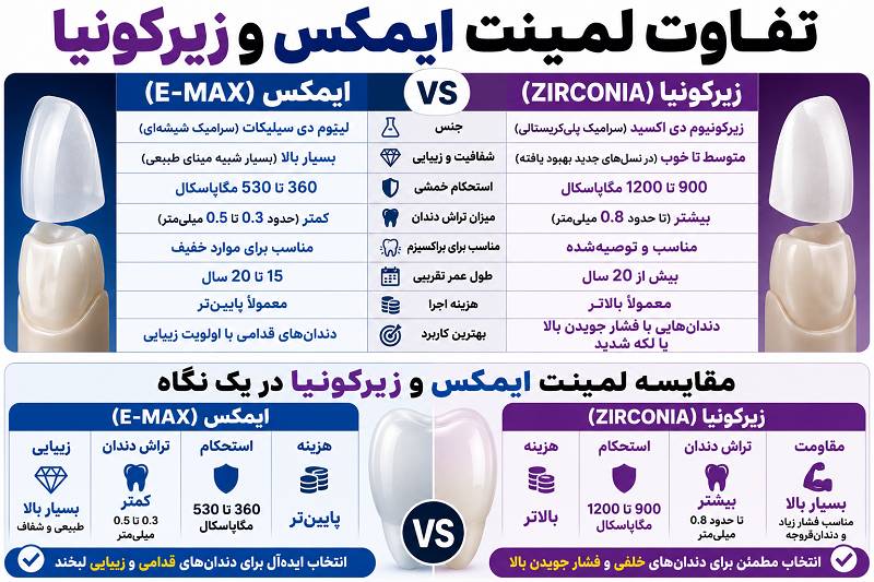 مقایسه لمینت ایمکس و زیرکونیا