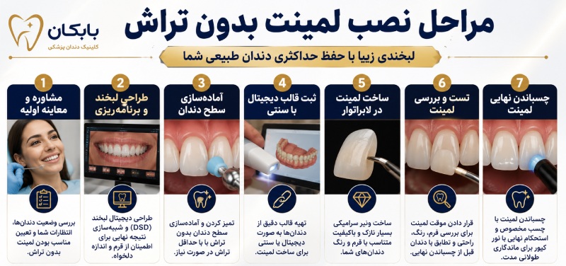مراحل لمینت بدون تراش