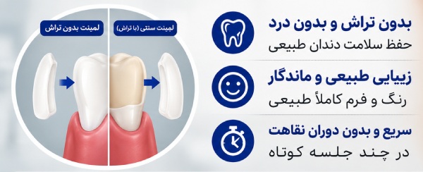 مزایا لمینت بدون تراش