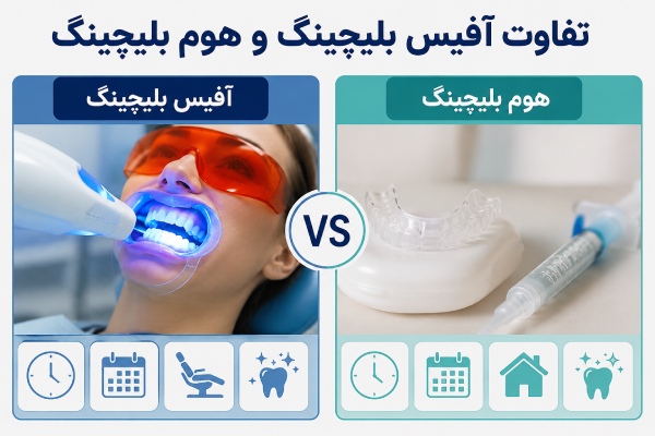 تفاوت آفیس بلیچینگ و هوم بلیچینگ