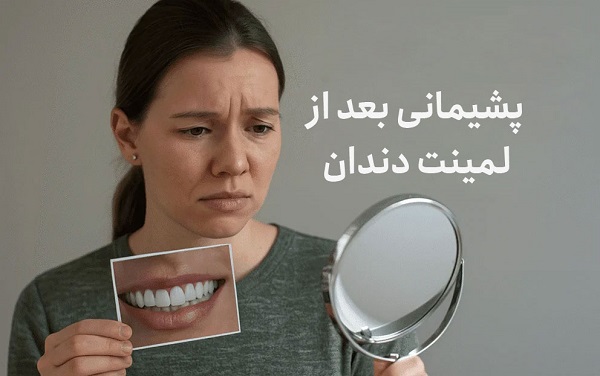 پشیمانی بعد از لمینت