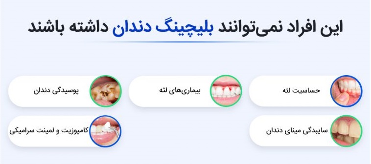 افرادی که نباید بلیچینگ دندان انجام دهند 