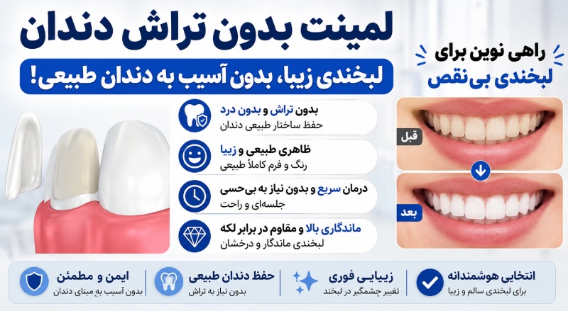 لمینت بدون تراش دندان