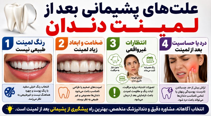 پشیمانی بعد از لمینت دندان