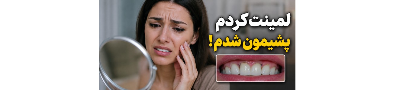 پشیمان شدن بعد از لمینت کردن دندان
