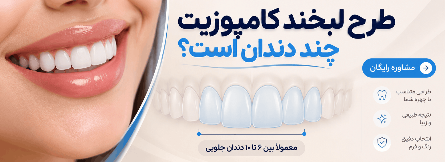 طرح لبخند کامپوزیت چند دندان است
