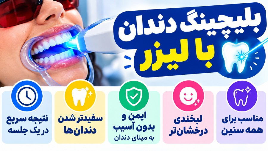 بلیچینگ یا سیفید کردن دندان با لیزر