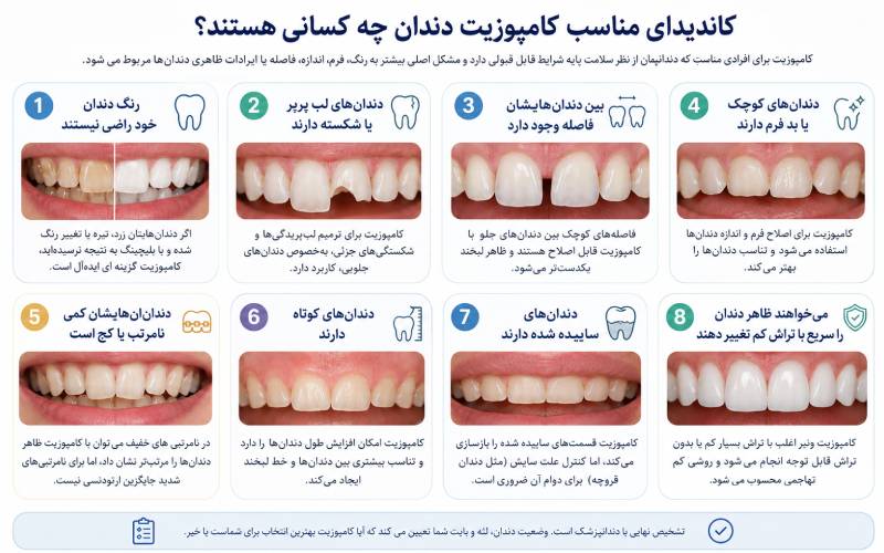 کامپوزیت دندان برای چه دندان هایی مناسب است