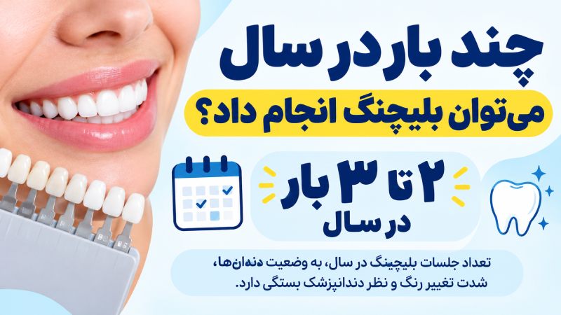 چند بار در سال میتوان بلیچینگ کرد؟