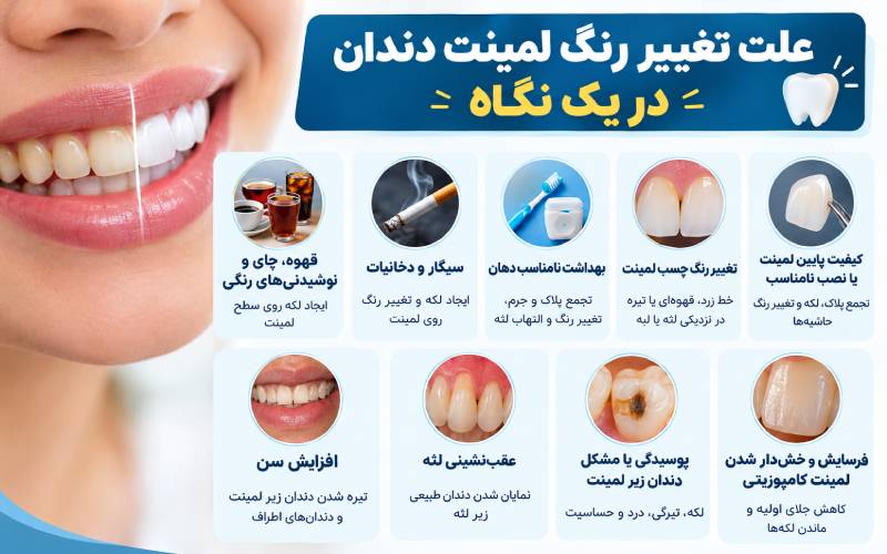 چرا لمینت دندان تغییر رنگ می‌دهد؟