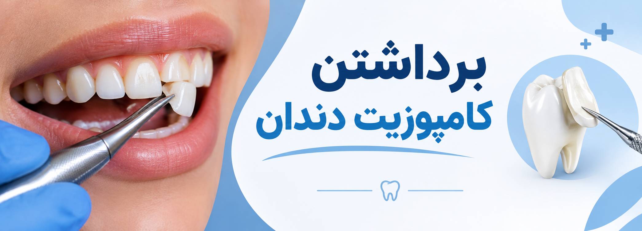 برداشتن کامپوزیت دندان