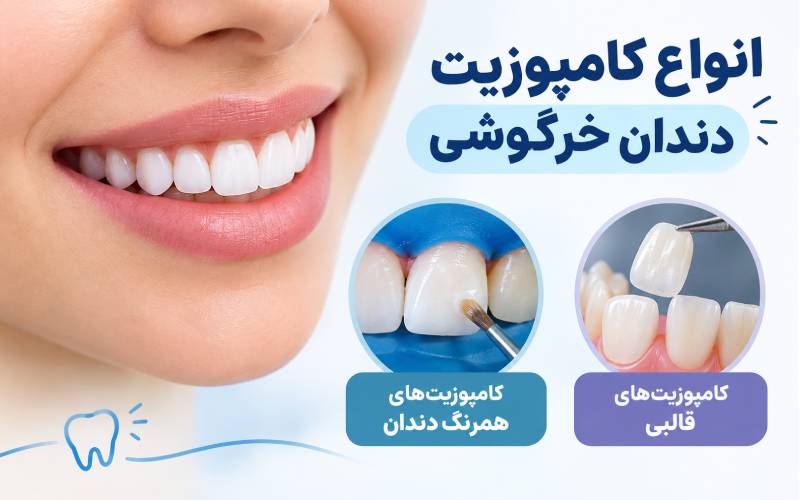 طرح لبخند دندان خرگوشی